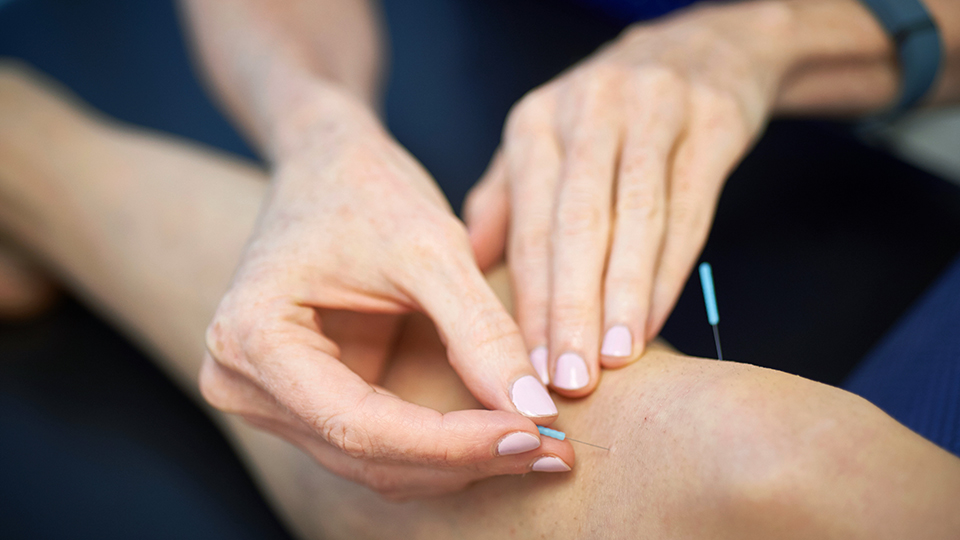 Healthcare Professional Administering Acupuncture Treatment